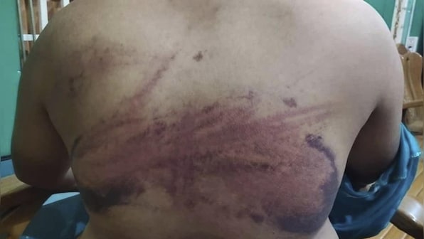 Myanmar military uses systematic torture across country to quash dissent, shows investigation