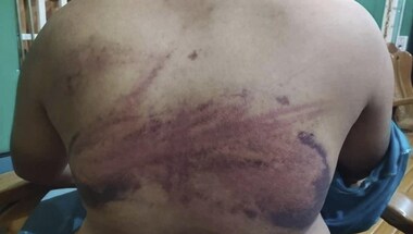 Myanmar military uses systematic torture across country to quash dissent, shows investigation
