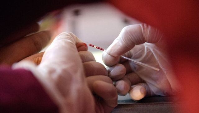 World AIDS Day 2021: Remembering the HIV epidemic in times of coronavirus World AIDS Day 2021: Remembering the HIV epidemic in times of coronavirus