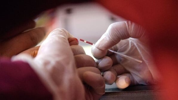 World AIDS Day 2021: Remembering the HIV epidemic in times of coronavirus