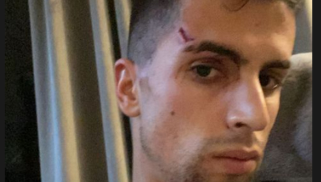 Premier League: City's Joao Cancelo reveals suffering facial injuries while fighting off 'four cowards' Premier League: City's Joao Cancelo reveals suffering facial injuries while fighting off 'four cowards'