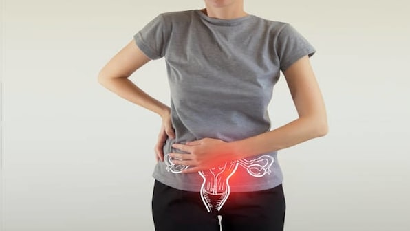  Cervical Cancer Screening: What women should know?