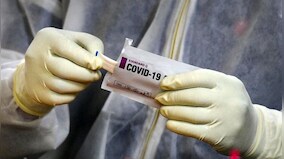 Long COVID-19: Breathlessness, eye problem, muscle weakness, dementia most common symptoms, say doctors