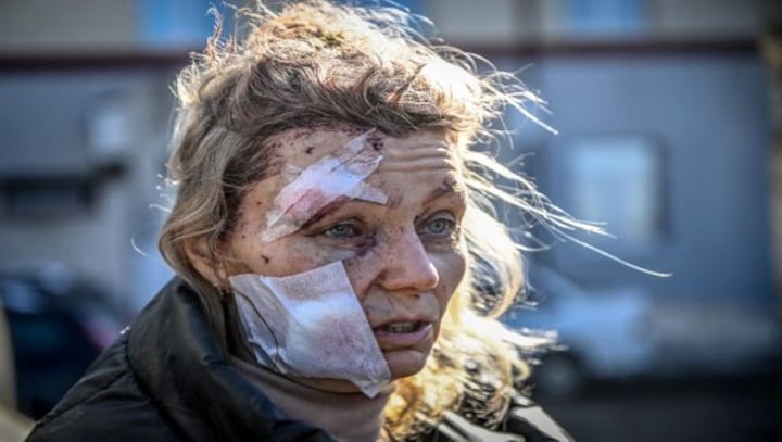 Buildings reduced to debris, bloodied faces: What Ukraine looks like after Russia's military offensive