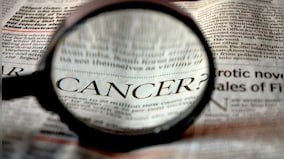 World Cancer Day: Best cure for cancer is early detection