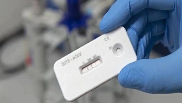 Sale of COVID-19 home tests surge but many failing to report results; experts flag risks Sale of COVID-19 home tests surge but many failing to report results; experts flag risks