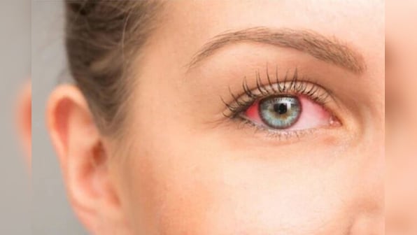 How to maintain healthy vision? Here are some ways