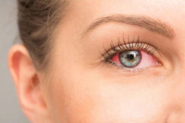 International Women's Day: Women more prone to vision loss compared to men