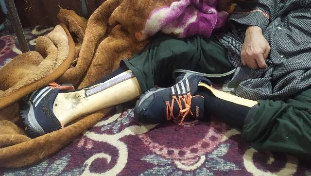Orthosis used to support Irshad's Legs. Image by Farzana Nisar