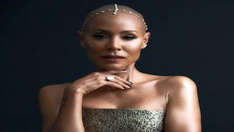 Alopecia Areata: The autoimmune condition that Will Smith’s wife Jada Pinkett Smith suffers from