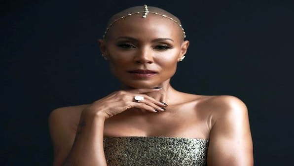 Alopecia Areata: The autoimmune condition that Will Smith’s wife Jada Pinkett Smith suffers from