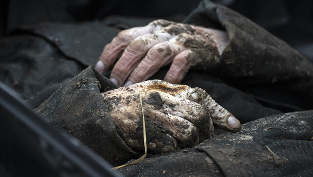 Bucha civilians were killed by Russian metal darts: What are these World War I weapons? Bucha civilians were killed by Russian metal darts: What are these World War I weapons?