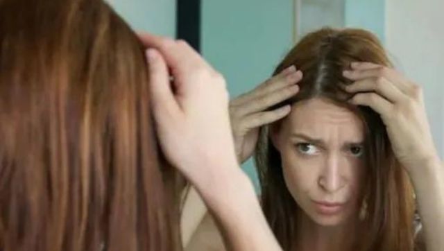 Here are some tips to deal with an excessively greasy scalp Here are some tips to deal with an excessively greasy scalp