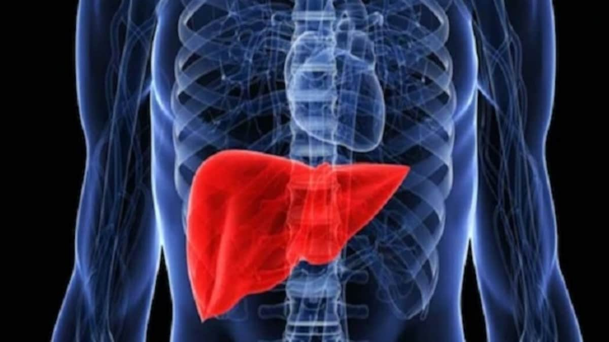 How fatty liver disease can become fatal