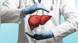 How lifestyle changes and food modification help to cure fatty liver