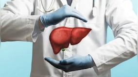 How lifestyle changes and food modification help to cure fatty liver