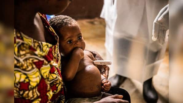 After UK and Europe, rare monkeypox case found in US: What you must know about the virus