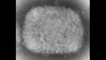 US confirms its first case of monkeypox in Massachusetts man