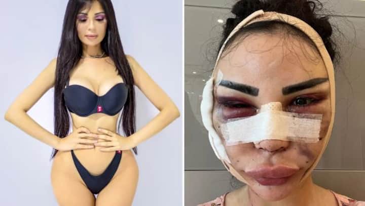 She spent $600K to be like Kim Kardashian, now paying $120K to 'detransition'