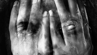 Jharkhand: Acid attack victim airlifted to AIIMS Delhi for 'specialised treatment'