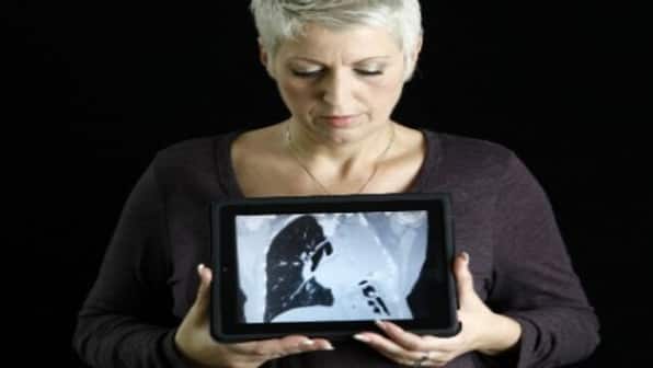 World Lung Cancer Day 2022: All you need to know about its history and significance