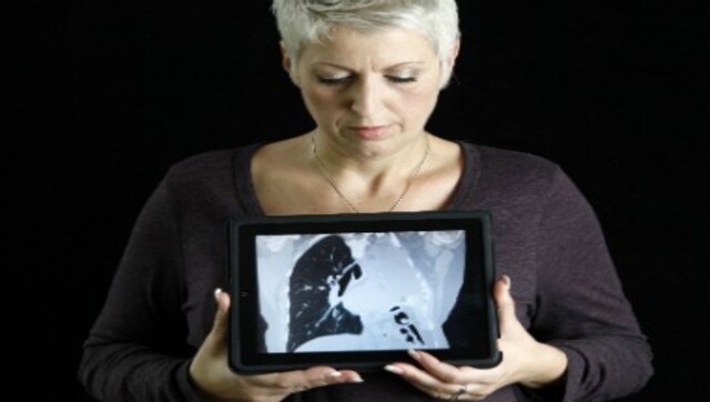 World Lung Cancer Day 2022: All you need to know about its history and significance World Lung Cancer Day 2022: All you need to know about its history and significance