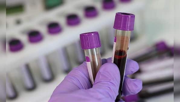 Explained: What is the Ebola-like Marburg virus reported in Ghana?
