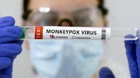 Explained: Why WHO has asked people to reduce number of sex partners amid monkeypox menace