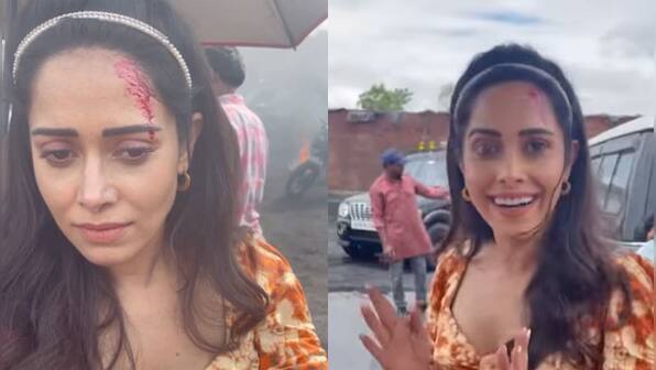 Nushrratt Bharuccha is ready for action, flaunts her bruises in latest Instagram post
