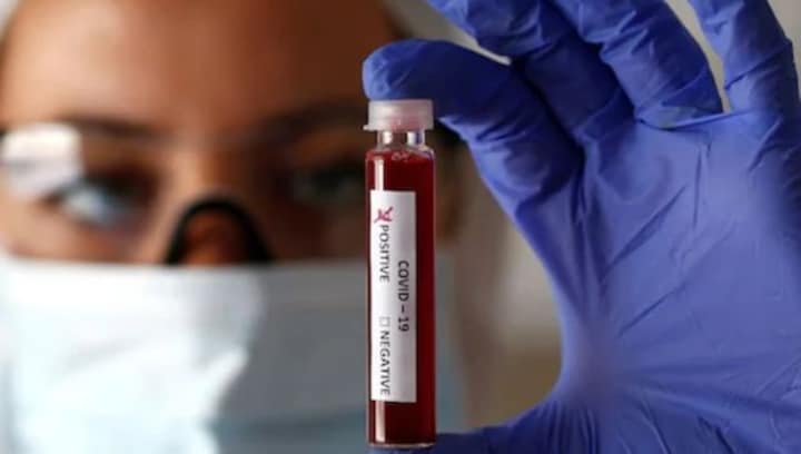 New easy-to-use test can tell how much immunity you have against COVID-19