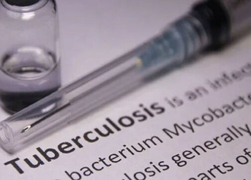 PM Modi to launch scheme to support nutritional needs of TB patients as India aims to eradicate the deadly disease PM Modi to launch scheme to support nutritional needs of TB patients as India aims to eradicate the deadly disease