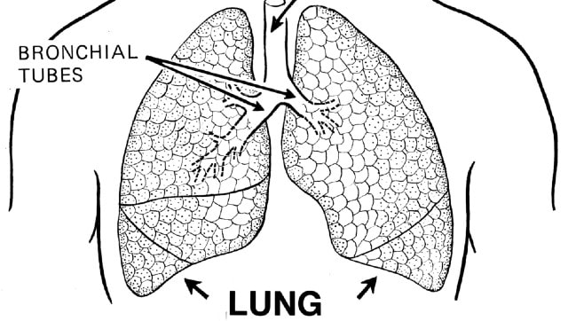 Why rehabilitation post lung transplant is critical to ensure optimum success of procedure