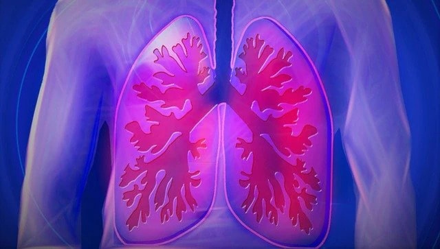 Five ways to reduce risk of lung cancer