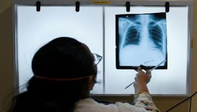 India Rejects J&J Plea To Extend Patent On Key Tuberculosis Drug, Drop ...