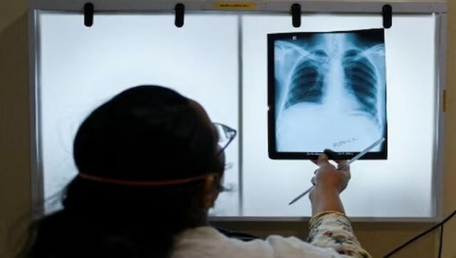 India Rejects J&J Plea to Extend Patent on Key Tuberculosis Drug, Drop in Prices Expected