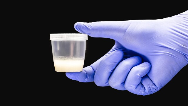 Dutch man banned from sperm donations after he 'illegally' fathered over 500 children 