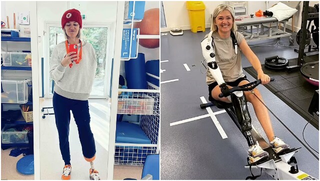 80% human, 20% robot: Woman who lost her limbs in two train accidents ...