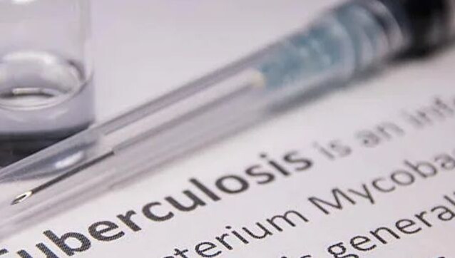 US woman arrested after year-long tuberculosis treatment refusal US woman arrested after year-long tuberculosis treatment refusal
