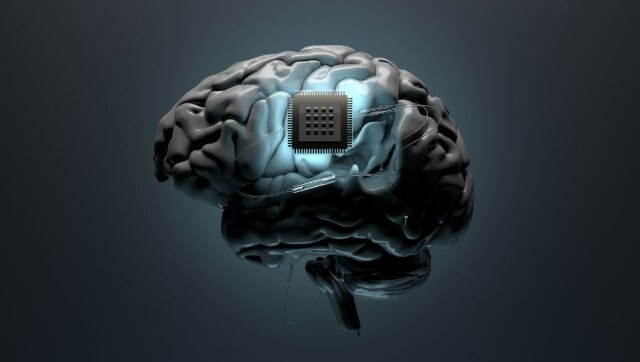 Brain-o-Scope: UN warns Neuralink-like AI-brain implants will hack your head