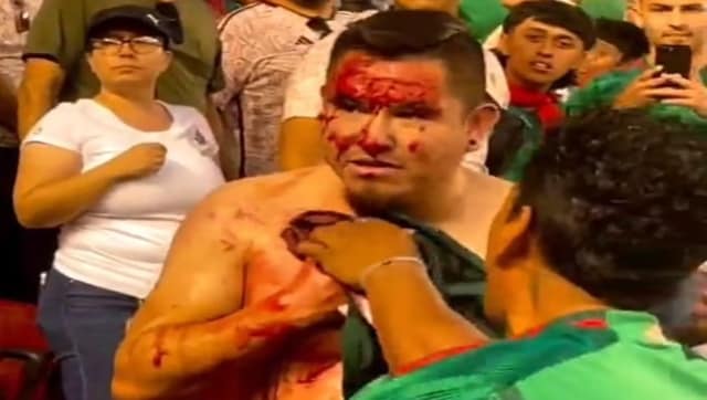 Mexico fan left with blood pouring from chest after being stabbed during Gold Cup match