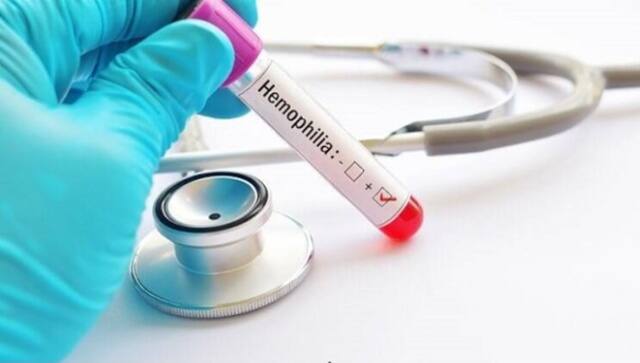 World Hemophilia Day 2021: Significance of day aimed at raising awareness about rare blood disorder