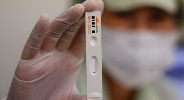 COVID-19 Testing: US FDA approves new antigen test for the detection of coronavirus infection COVID-19 Testing: US FDA approves new antigen test for the detection of coronavirus infection