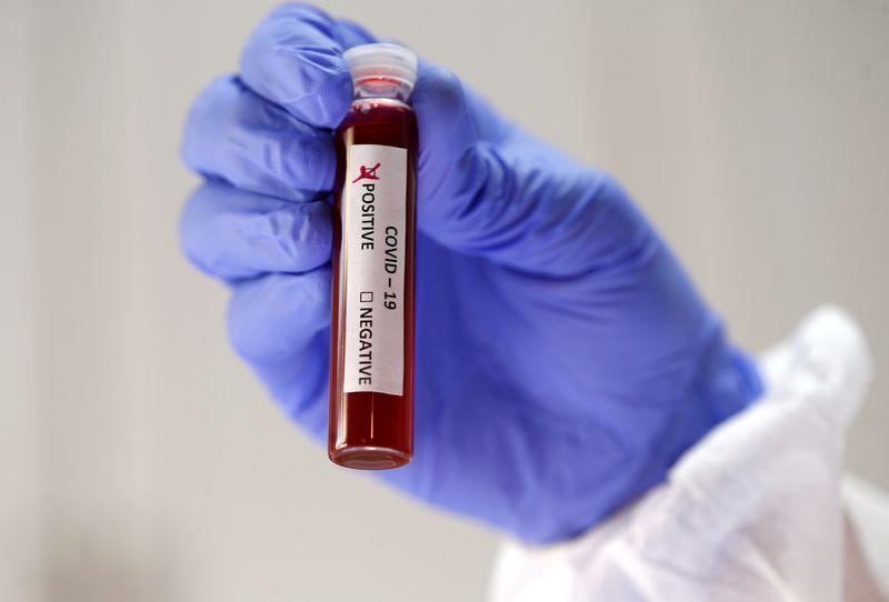 Serbian scientists set first Europes coronavirus death at February 5 2020