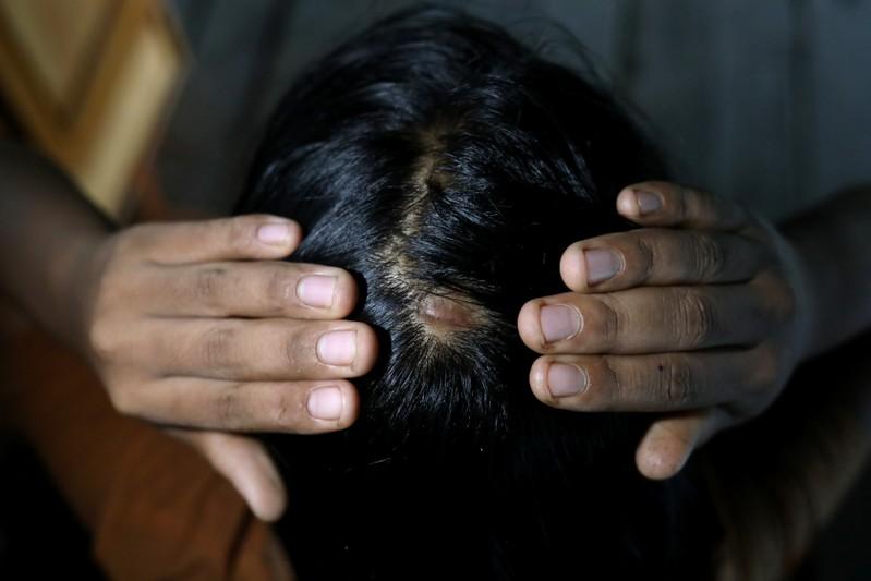 'Until her bones are broken': Myanmar activists fight to outlaw domestic violence 'Until her bones are broken': Myanmar activists fight to outlaw domestic violence